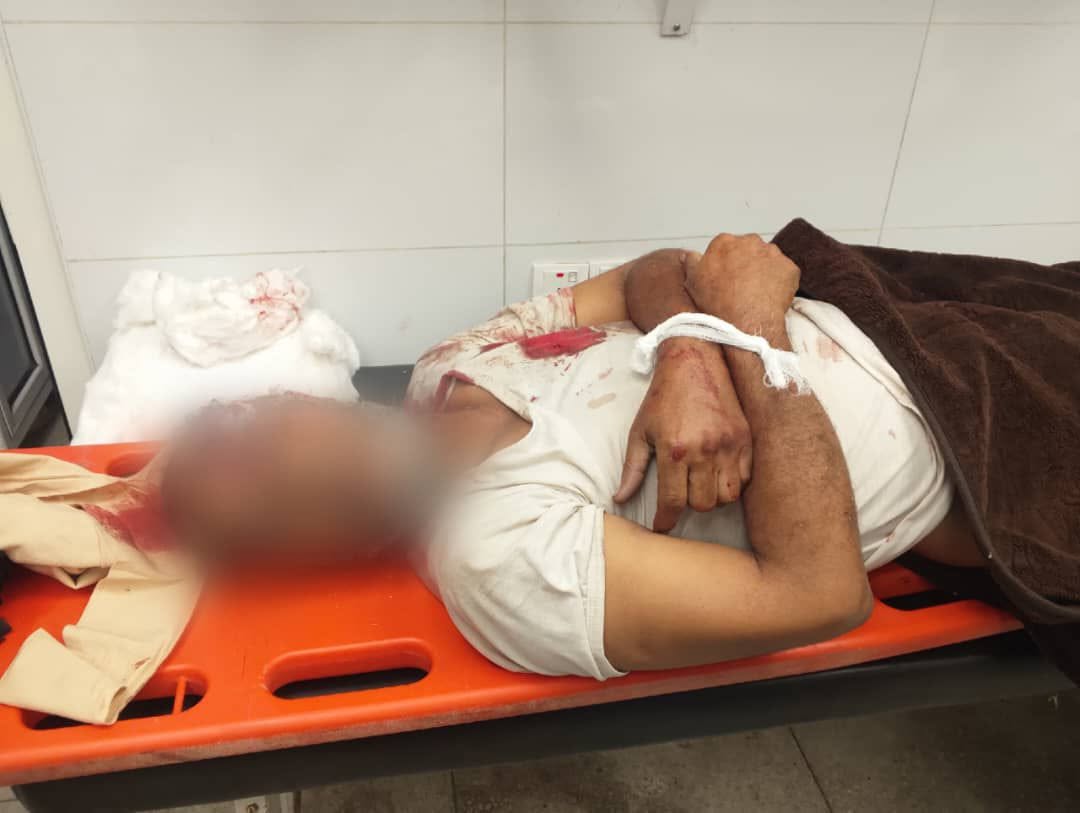 تقرير حقوقي: توثيق 42 انتهاكاً حوثياً وإطلاق 369 مقذوفاً في تعز خلال يومين
