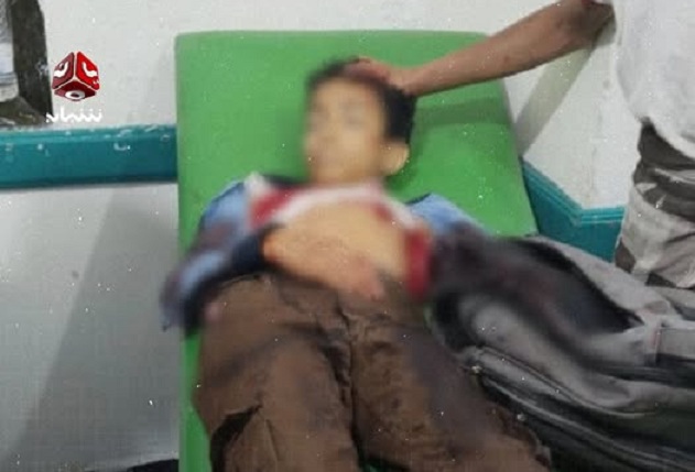 استشهاد طفل برصاص قناص حوثي أثناء عودته من المدرسة شمالي تعز