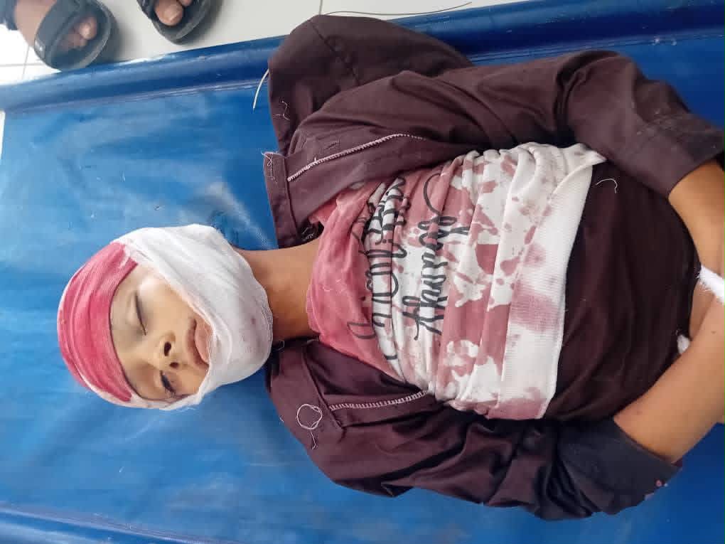 مجزرة بشقب صبر: شهيدين و6 جرحى في هجوم حوثي مدمر