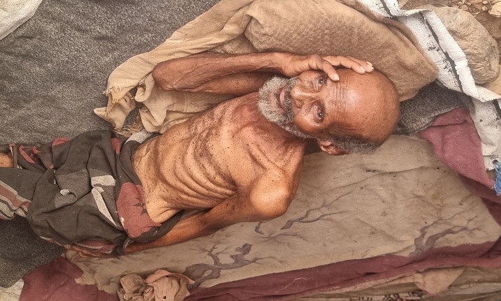 وفاة مُسن نتيجة الجوع في مخيمات النزوح بمحافظة حجة