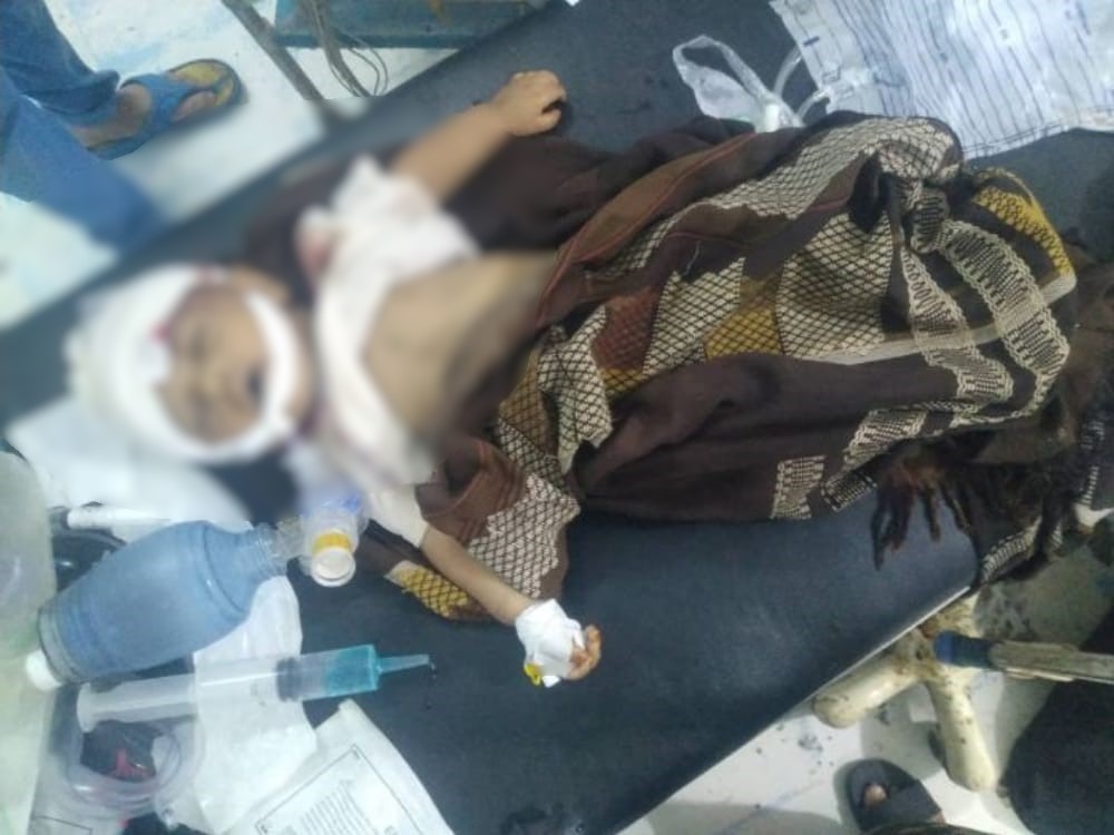 تعز.. مقتل طفل رضيع بقصف لمليشيا الحوثي في إحدى قرى "مقبنة"