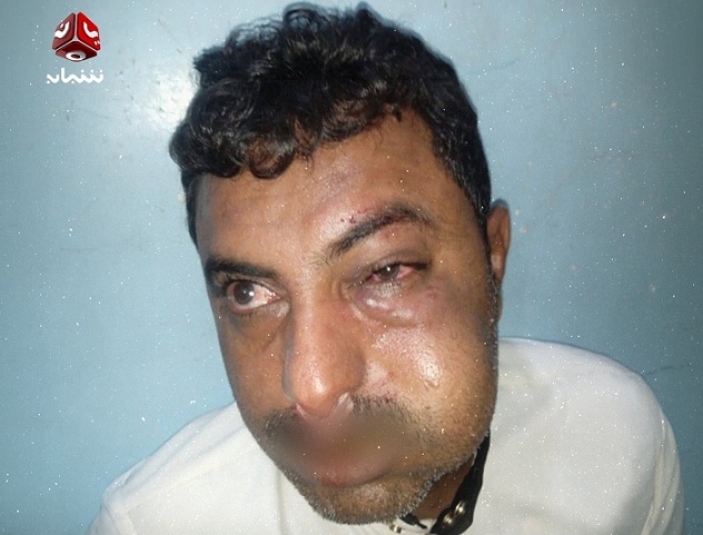 قيادي حوثي يعتدي بالضرب على محامٍ في مدينة زبيد بالحديدة