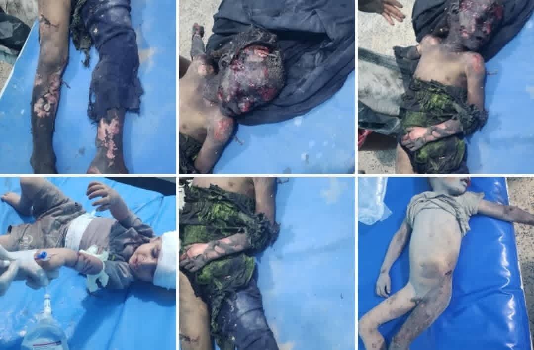 مأرب.. مقتل طفلين وإصابة 15 آخرين إثر استهداف مليشيا الحوثي مخيم للنازحين في رغوان