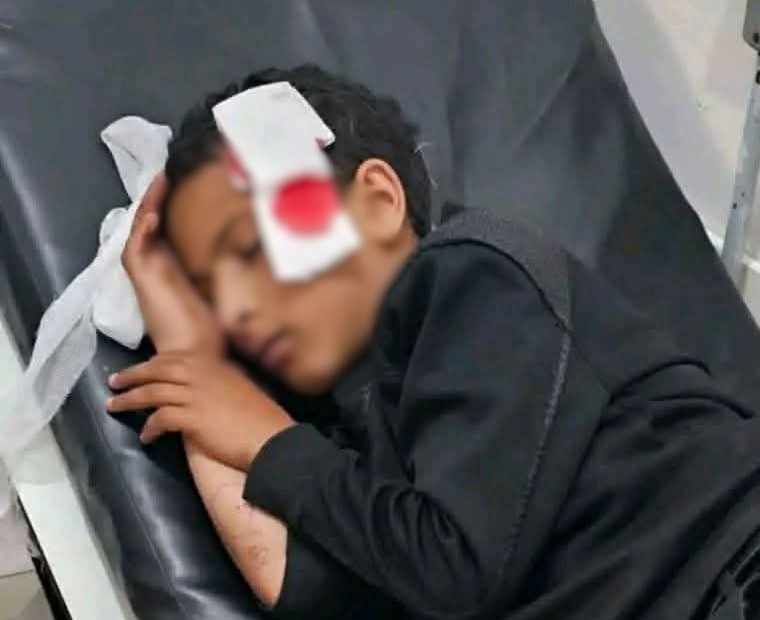 تعز.. إصابة طفل برصاص قناص حوثي في "صبر الموادم"