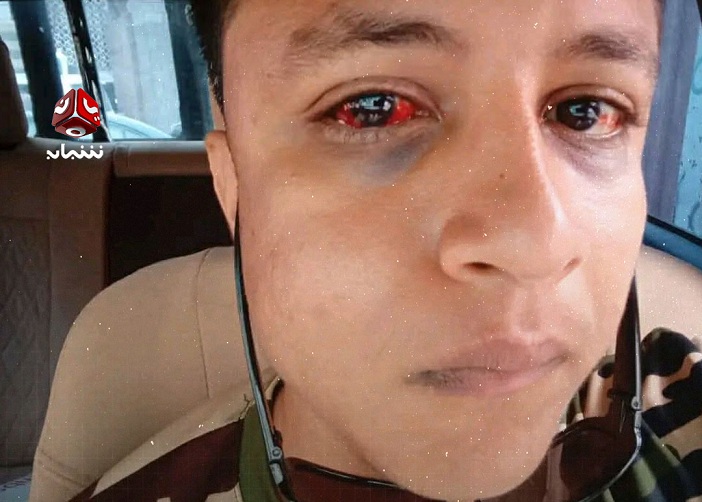 عدن.. شاب يشكو من تعرضه للاحتجاز والتعذيب داخل قسم للشرطة أثناء زيارته للنزلاء