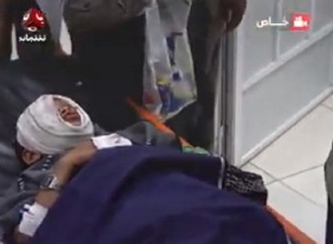 تعز.. إصابة طفل بشظايا قذيفة من مخلفات مليشيا الحوثي جنوبي المدينة