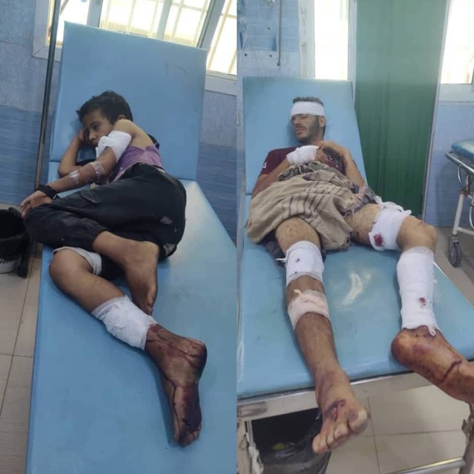 إصابة شقيقين بانفجار عبوة ناسفة من مخلفات مليشيا الحوثي في تعز