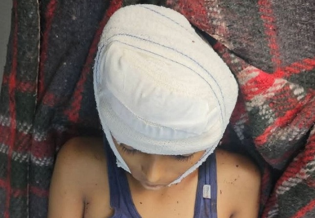 تقرير أممي: مقتل وإصابة 176 مدنياً منذ بدء التصعيد الحوثي في اليمن