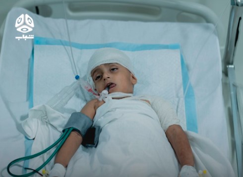 استشهاد طفل وإصابة خمسة مدنيين بقصف حوثي على حي سكني في تعز