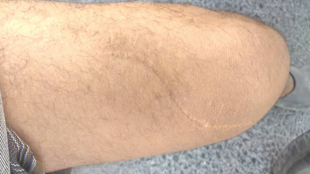 سجون الإمارات في اليمن: الناشط "باقطيان" يروى قصة تعذيبه في مطار الريان