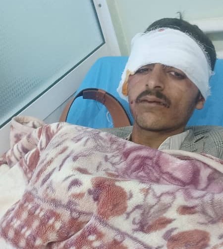إصابة 19 شخصاً بينهم مشرف حوثي بانقلاب سيارة أثناء حشدهم لحضور فعالية طائفية في ريمة