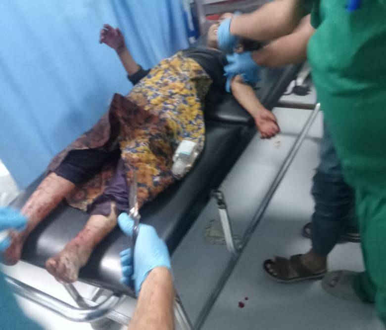 الضالع.. مقتل وإصابة 13 طفلاً بانفجار مخلفات حوثية والمحافظ يوجّه برفع الاستنفار الطبي