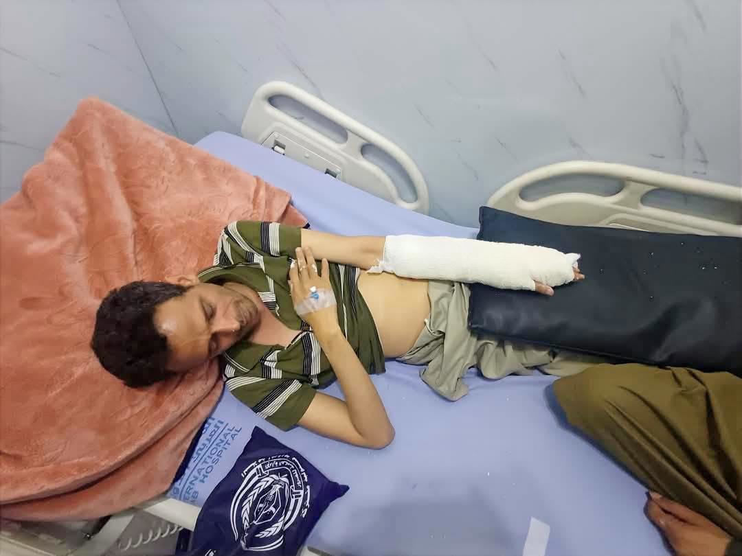 صنعاء.. عصابة تعتدي على ناشط حوثي تحدث عن فساد قيادات الحوثيين