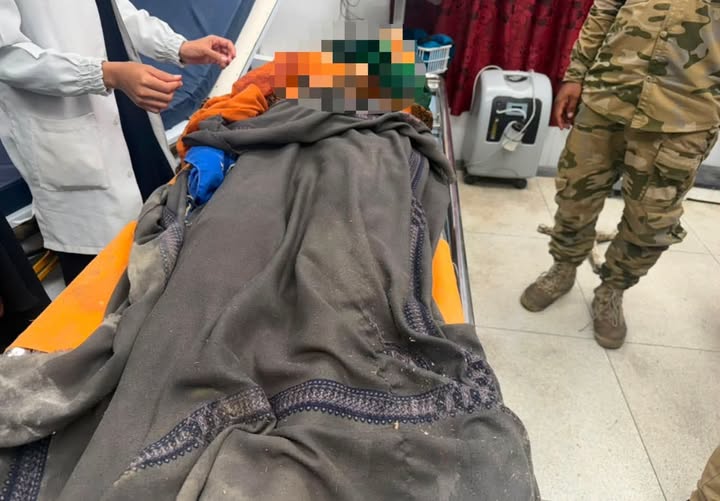 مقتل امرأة بانفجار لغم حوثي جنوب شرقي تعز