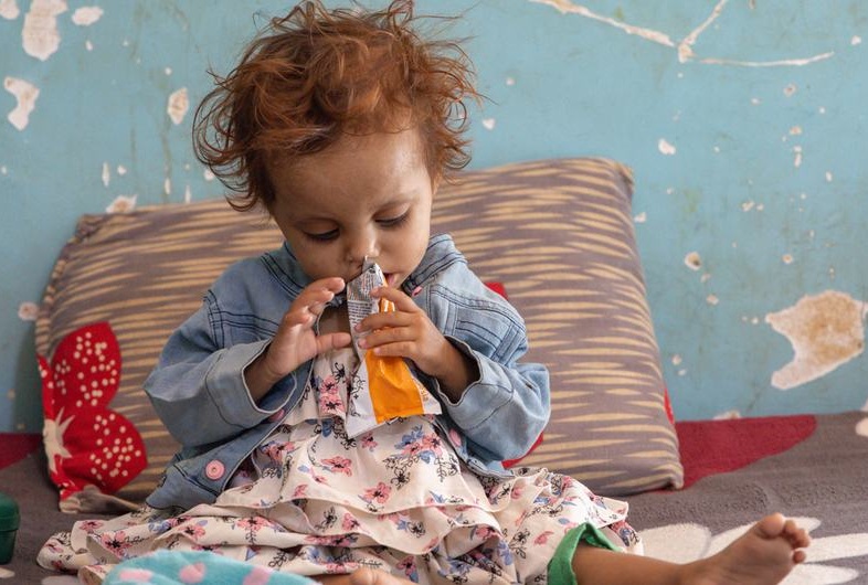 الأمم المتحدة: الجوع والنزوح يفاقمان معاناة أطفال اليمن