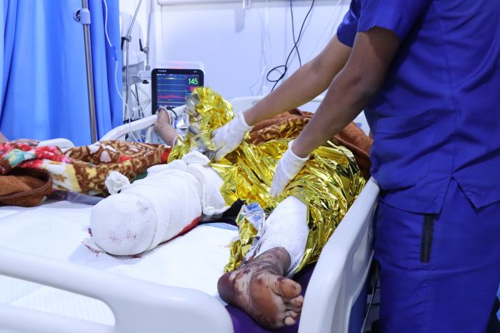 تعز.. إصابة أربعة أشخاص بانفجار لُغمين من مخلفات مليشيا الحوثي في ذو باب