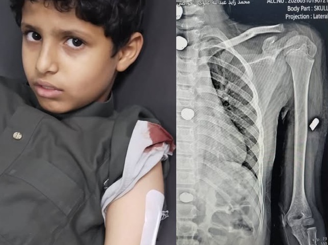 شبوة.. إصابة امرأتين وطفل جراء تبادل إطلاق نار في عتق