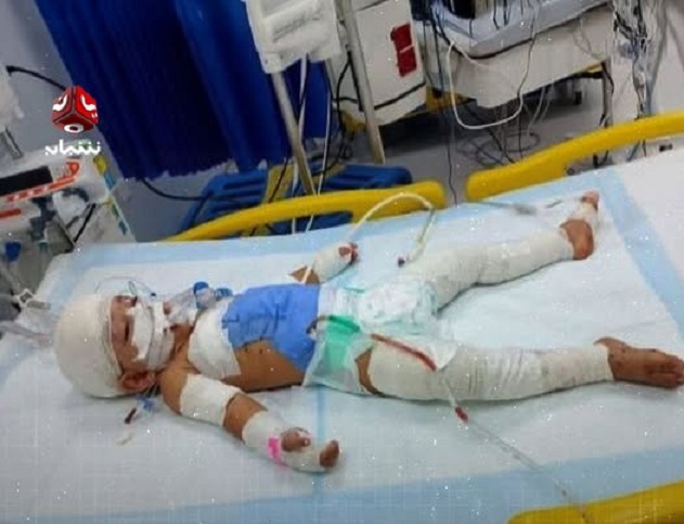 أدانت مجزرة حيران.. منظمة دولية: أطفال اليمن يُستهدفوا في الأماكن التي ينبغي أن تكون ملاذاً آمناً لهم